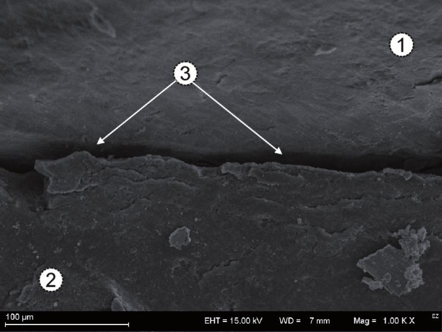 a) Diagram of the studied tooth specimens: A1, A2, B1, B2 areas of observation marginal fissure; b) view of the tooth specimen used in observation under optical microscope Na rysunku 9 przedstawiono