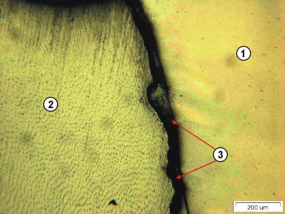 Science and Technology Rys. 10. Obraz powierzchni przekroju wzdłużnego zęba uzyskany z mikroskopu optycznego: 1 wypełnienie kompozytowe, 2 zębina, 3 szczelina brzeżna Fig. 10. Image of the surface of longitudinal section of the tooth under optical microscope: 1-composite filling, 2-dentine, 3-marginal fissure Rys.