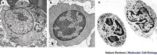Dwa podstawowe stany chromatyny Euchromatyna Heterochromatyna dostępna, plastyczna Komórki: macierzyste młode nowotworowe niedostępna, nieplastyczna Komórki: zdeterminowane,