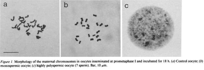Morfologia matczynych chromosomów w oocytach