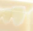 ) Röders RXD Serie (Röders GmbH) inlab MC X5 (Sirona Dental Systems GmbH) Wskazówka: zasadniczo