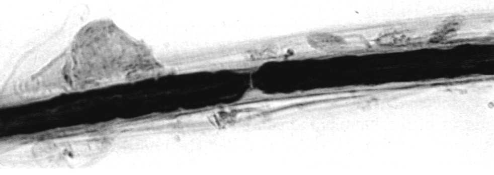 niewielką ilością białek mezakson Przewężenie Ranviera styk dwóch segmentów osłonki mielinowej fałdy cytoplazmy