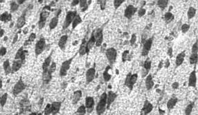 włókniste Komórki mikrogleju (mezogleju) są odmianą