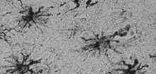 protoplazmatyczny mezogleju Astrocyt włóknisty