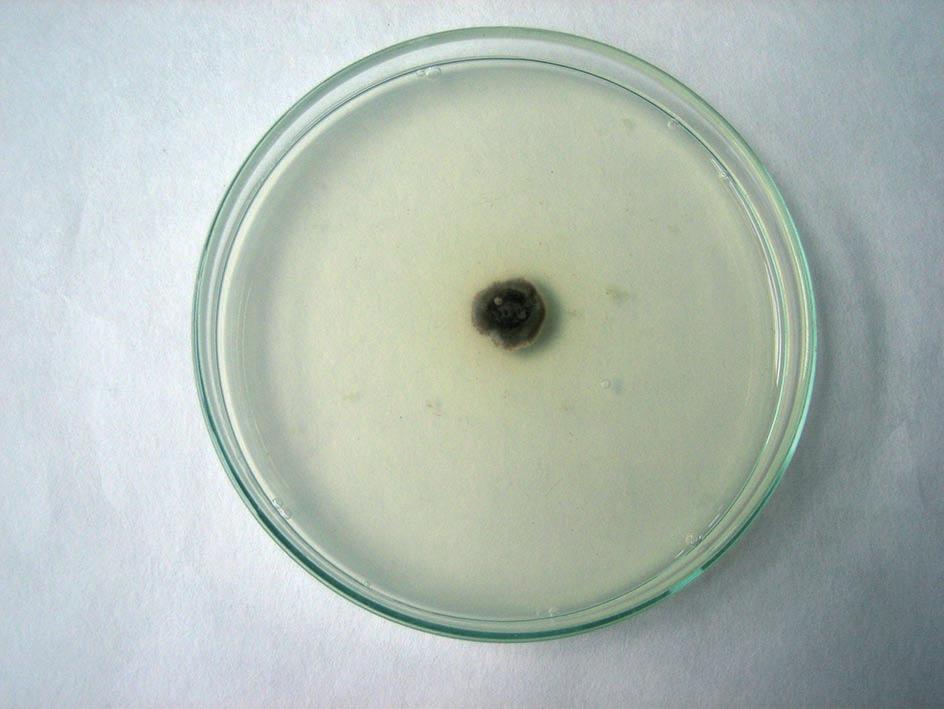 Occurrence of eyespot on winter wheat in the Central-Southern region of Poland 429 The most important element of performed research was to identify fungal species of causal disease agents, as it