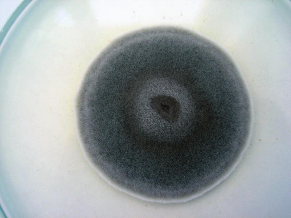 The use of specific for W or R types primers enabled the confirmation laboratory studies and their correct classification