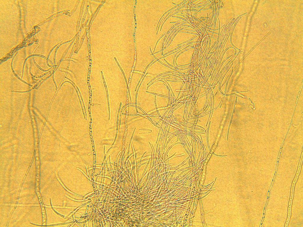 Occurrence of eyespot on winter wheat in the Central-Southern
