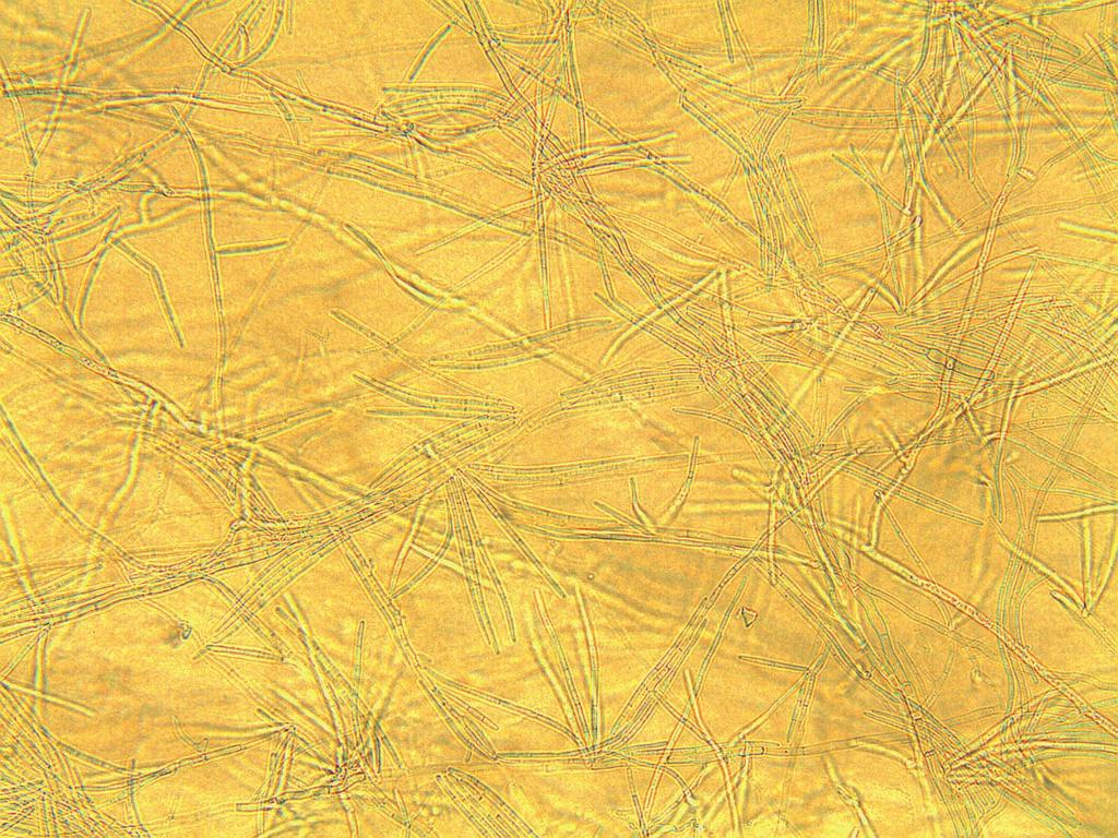 yallundae (a), O.