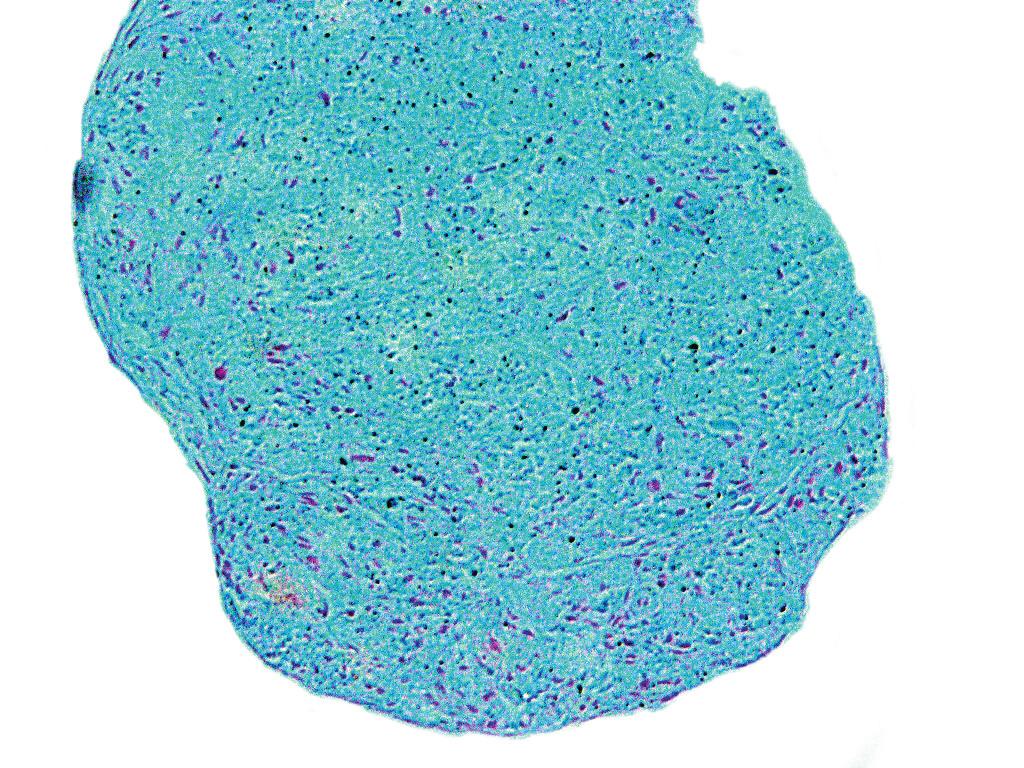 Role of inﬂammatory factors and adipose p tissue in p pathogenesis g of rheumatoid arthritis and osteoarthritis. Ryc. 3.