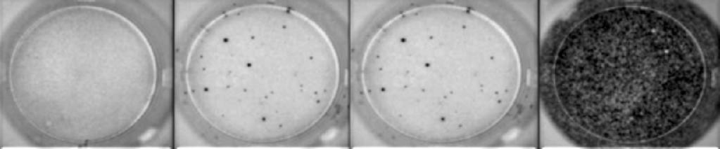 Dagmara Borkowska i wsp., Interferonowy test T-SPOT.TB w diagnostyce latentnego zakażenia prątkiem gruźlicy Rycina 1. Zasada testu T-SPOT.TB Figure 1. The main steps of the T-SPOT.TB assay Rycina 2.