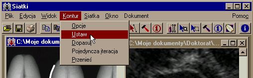 Program do omputerowe analzy obrazów za pomocą deformowalnych model odcnaa zamast po cztery. Odpowedno zmodyfowane est równeż równane 10 16. punt węzłowy a b c tróąt równoboczny Rys.5.