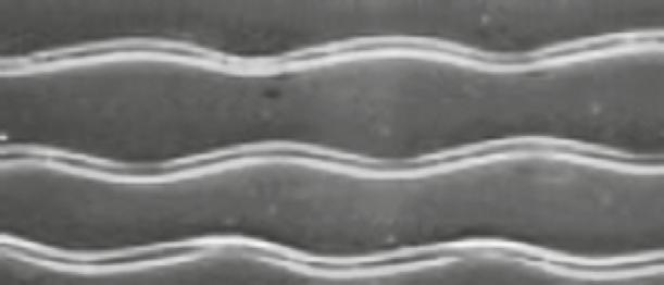 Technologia wymiennych końcówek Rozdział 4 Technologia wymiennych końcówek Główki pierwszych manualnych szczoteczek do zębów były bardzo duże i zakończone twardym i sztywnym włosiem