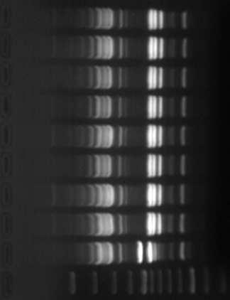 FORL, A 100 3-37 amplifikacja DNA z pojedynczych