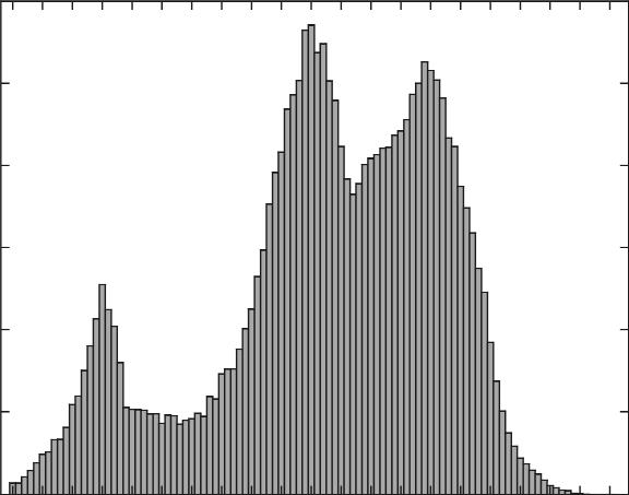 Fig. 2. Distribution of age for hospitalized men (up) and women (down) in Silesia region in 1999-23. wiek pacjenta się w przedziale od 58 do 65 na 1 tys.