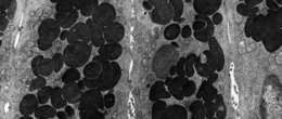 szorstka śluzowe ziarna wydzielnicze mikrokosmki na powierzchni
