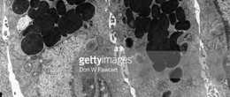 komórki okładzinowe komórki dokrewne - enteroendokrynowe