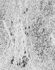 Komórki Müllera (2) Pigmentowane komórki w rejonie przejścia
