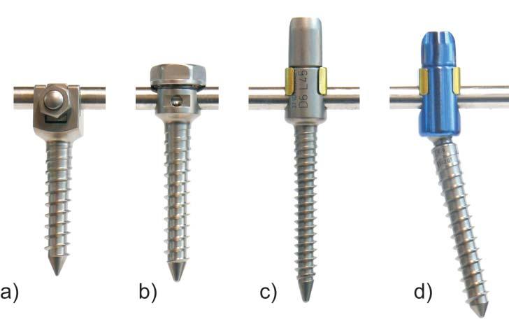 relation to the length of the screw. Despite the optimization of mechanical construction of the screw, creation of the screw fully capable of bearing bio-loadings in the human spine failed.