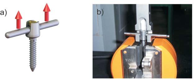 Improving of transpedicular stabilization using SGL Self Guided Lock procedure 125 screw socket according to ASTM F1798.