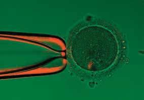 Zona pellucida birefringence on a 4-step