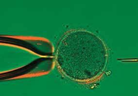 Visualized meiotic spindle localization in relation to the polar body on