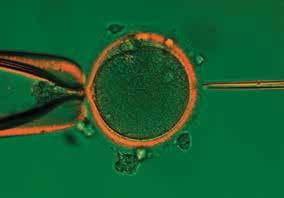An oocyte with a spindle forming at less than 30 (<30 ) to the polar body.