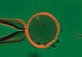 An oocyte with a spindle forming at 30-45 (30 <45 ) to the polar body.