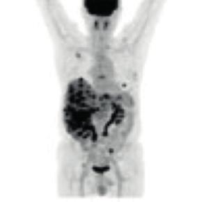 Interpretacja obrazów Obraz CT dostarcza lekarzowi informacji o strukturach anatomicznych, co umożliwia bardzo dokładne określenie lokalizacji zmian patologicznych.