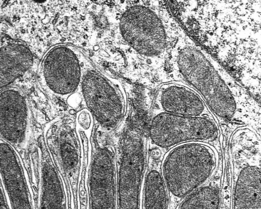 zagrażających komórce (spadek ph, nadmierny wzrost wewnątrzkomórkowego stężenia