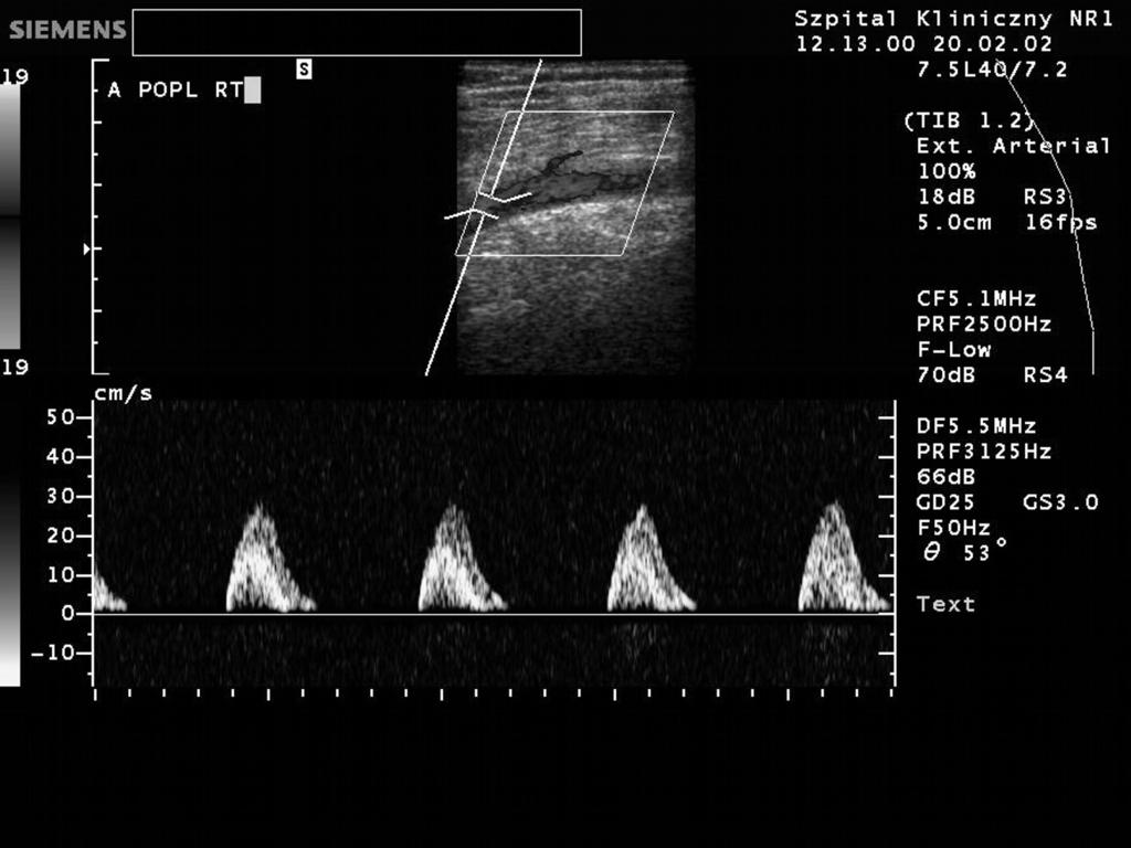 Ultrasonographic assessment of haemodynamic parameters of collateral circulation, Juszkat et al. Figure 2.