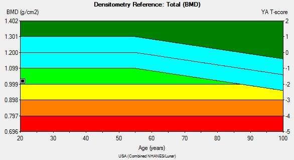 Densytometria Norma: powyżej -1 Osteopenia: od -1 do -2.5 Osteoporoza : poniżej -2.