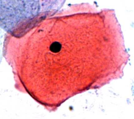 Adaptacyjna metoda poprawy kontrastu dla cyfrowych obrazów rozmazów cytologicznych W starszych komórkach prawidłowych warstwy powierzchniowej