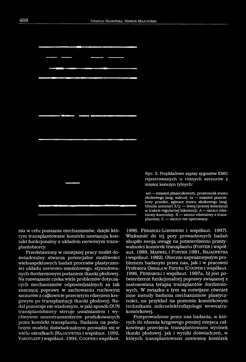 soleus), ta mięsień piszczelowy przedni, zginacz stawu skokowego (ang. tibialis anterior) (l/p lewej/prawej kończyny) w trakcie regularnej lokomocji.