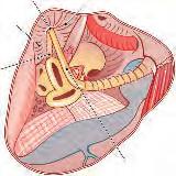 Chirurgia Kości Skroniowej Wytyczne z Zurychu 43 Komórki powietrzne leżące do przodu od tętnicy szyjnej mogą rozszerzać się do szczytu piramidy i ich usunięcie może wymagać precyzyjnej pracy wiertłem