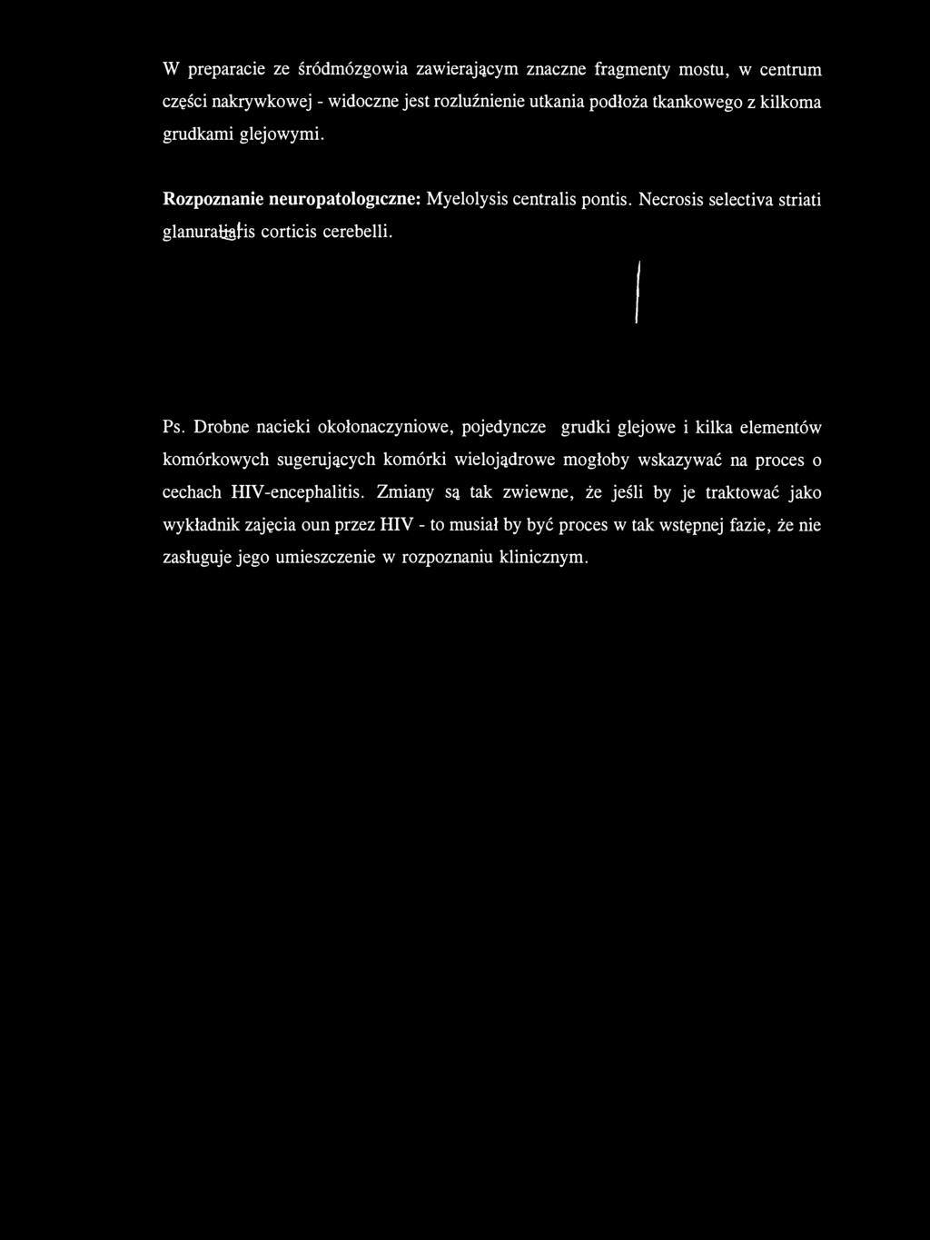 W preparacie ze śródmózgowia zawierającym znaczne fragmenty mostu, w centrum części nakrywkowej - widoczne jest rozluźnienie utkania podłoża tkankowego z kilkoma grudkami glejowymi.