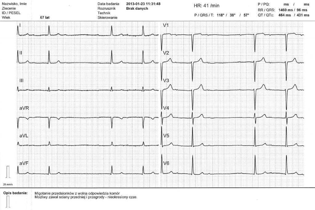 Rafał Baranowski, Jaki aparat EKG wybrać?