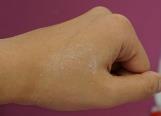 00 Bis-ethylhexyloxyphenol Methoxyphenyl Triazine (Tinosorb S, BASF) 2.50 TEGOSOFT TN (C12-15 Alkyl Benzoate) 2.00 Ethylhexyl Salicylate (PARSOL EHS, DSM) 2.00 Ceresin Wax (Kahlwax 4511 N, Kahl) 5.