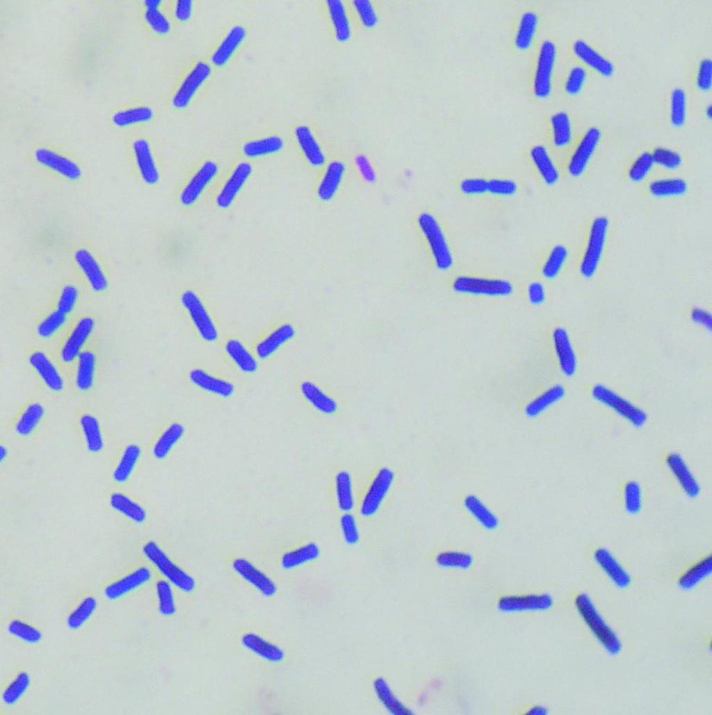 792 nego wzrostu szczepów typu A i wykazanie u nich dodatkowo zdolnoœci wytwarzania CPB2 (28). Diagnostyka laboratoryjna zaka eñ wywo³ywanych przez Cl.