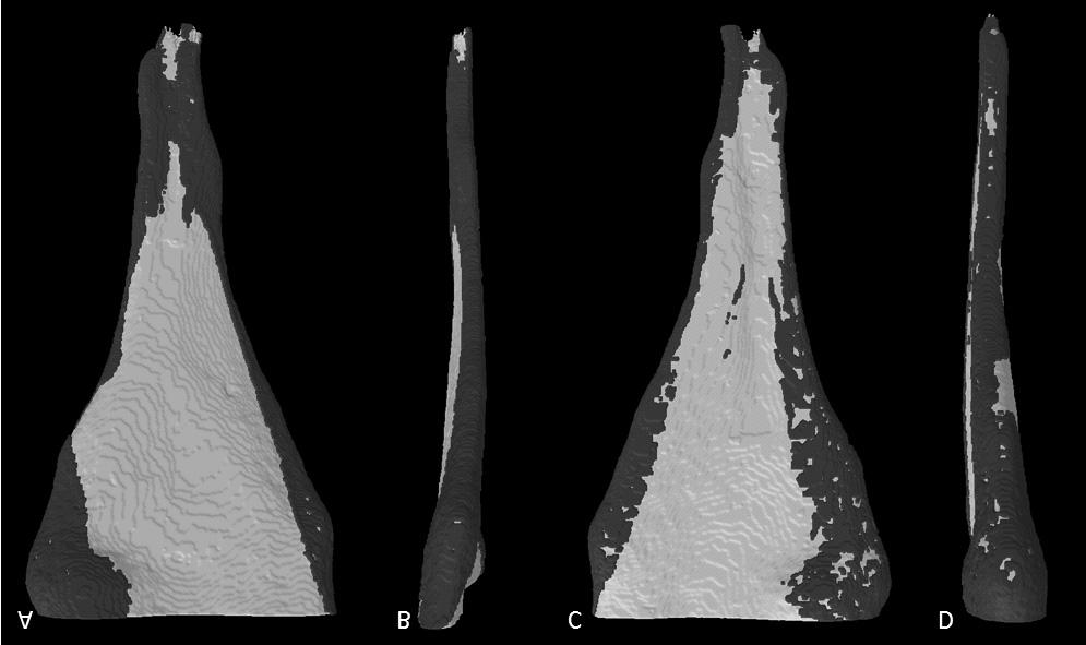 Three Dimensional Quality Evaluation... Introduction According to general teeth anatomy, clinicians should apply a proper technique of canals preparation during endodontic therapy.