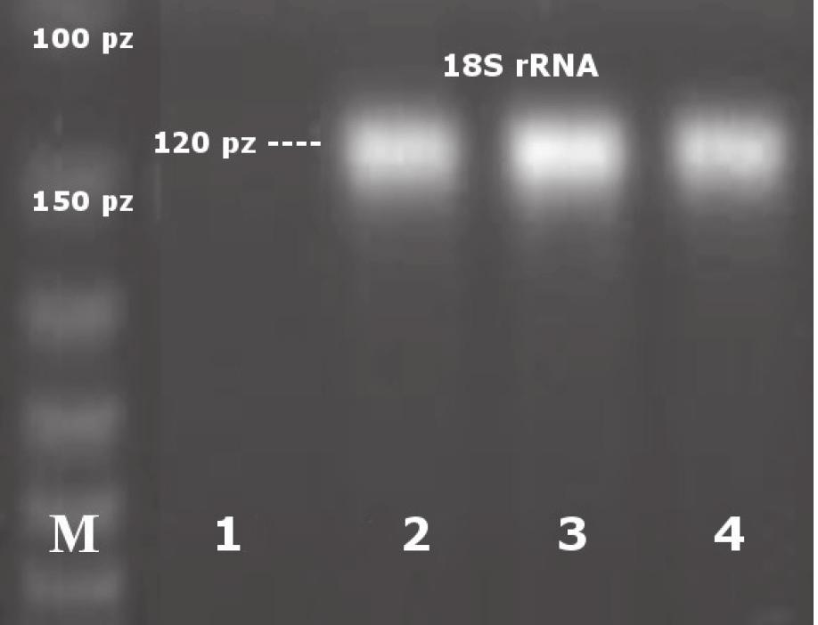 Metody oznaczania składu gatunkowego materiału biologicznego 143 i eukariontów. Przykładowe wyniki oznaczania eukariontów obrazuje fotografia 1. W wyniku analizy uzyskano produkty PCR (fot.