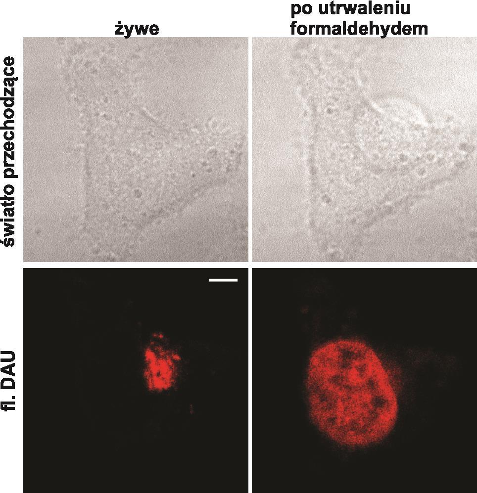 Rys. 5.1. Przestrzenny rozkład daunomycyny w żywej komórce oraz po utrwaleniu formaldehydem (wzmocnienie i inne parametry rejestracji obrazu były takie same dla obu obrazów) (skala 5 m).