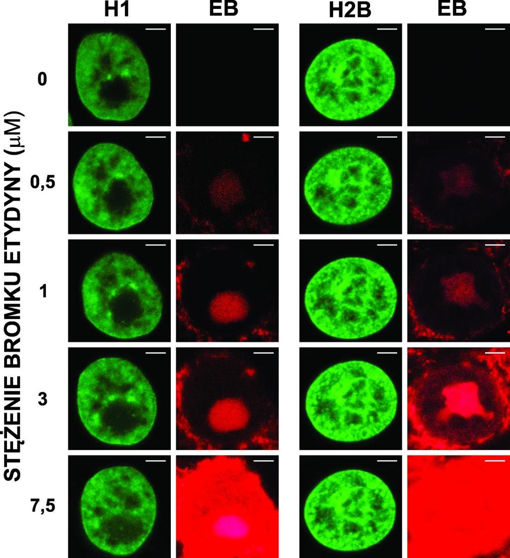 Rys. 5.11. Wpływ bromku etydyny na strukturę chromatyny w żywych komórkach. Komórki HeLa z histonami H1.