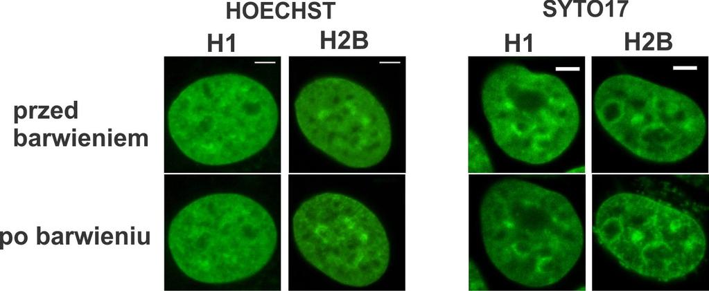 . Rys. 5.13. Wpływ barwników Hoechst 33258 oraz SYTO17 na strukturę chromatyny w żywych komórkach. Komórki HeLa z histonami H1.