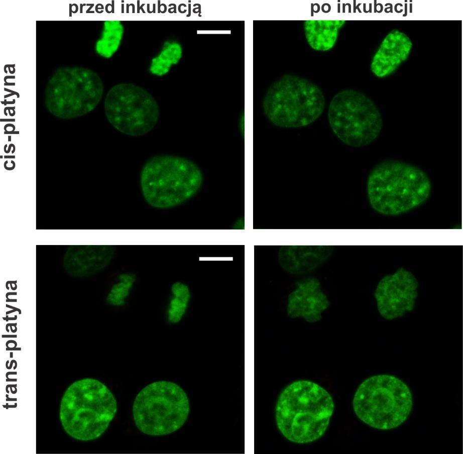 Rys. 5.14. Wpływ cis- i tran-platyny na strukturę chromatyny w żywych komórkach. Obrazy mikroskopowe komórek HeLa z histonami H1.