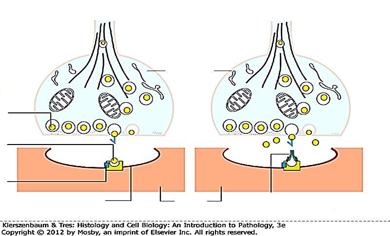 Myasthenia gravis (miastenia) p-ciała blokujące receptory dla (Ach) powodują osłabienie siły skurczu mięśnia Miastenia jest rzadką chorobą autoimmunologiczną, w której przeciwciała wiążą się z