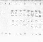 The usefulness of the thin-layer... 13 I II C C BE BE 1 2 3 4 5 6 7 8 9 10 11 III 1 2 3 4 5 6 7 8 9 10 11 IV C C BE BE 1 2 3 4 5 6 7 8 9 10 11 1 2 3 4 5 6 7 8 9 10 11 Fig. 1. Chromatograms of liver and kidney extracts in 4 optimal developing systems (compare Table I).