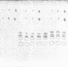 liver extract ( background ) without xenobiotics; 9 liver extract with C and BE: 1 g/g; 10 liver extract with C and BE: 2 g/g; 11 liver extract with C and BE: 5 g/g; background spots visible only in