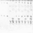 14 M. Kiszka, R. M¹dro C I C II BE BE 1 2 3 4 5 6 7 8 9 10 11 1 2 3 4 5 6 7 8 9 10 11 III IV C C BE BE 1 2 3 4 5 6 7 8 9 10 11 1 2 3 4 5 6 7 8 9 10 11 Fig. 2. Chromatograms of urine extracts in 4 optimal developing systems.