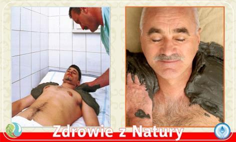 chlorkowo hydrowęglanowomagnezowych i siarczanowych hipotonicznych z wysoką koncentracją jodu, oraz borowinami bogatymi w sole
