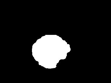 Fig. 1. Images from PH2 [10] database (upper row) with manually created lesion (lower row) Rys. 1. Przykładowe obrazy znamion z bazy PH2 [10] (górny rząd) wraz z ręcznie obrysowanymi konturami (dolny rząd) 2.